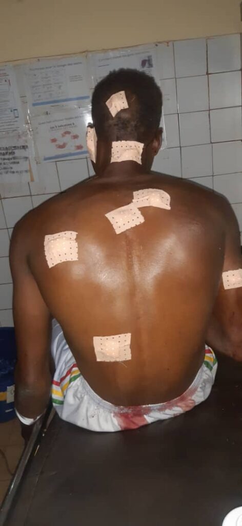 Siguiri: un homme blessé par balle par des inconnus.